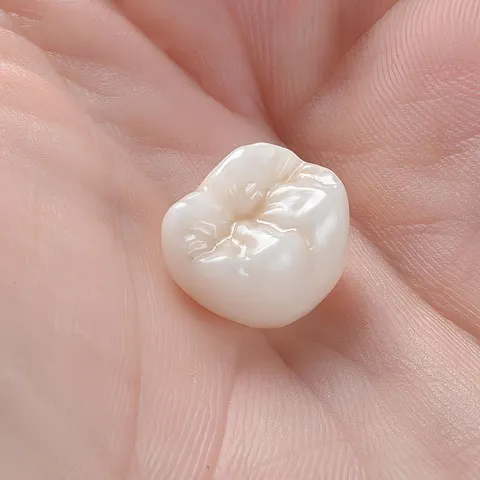 Dental Crowns