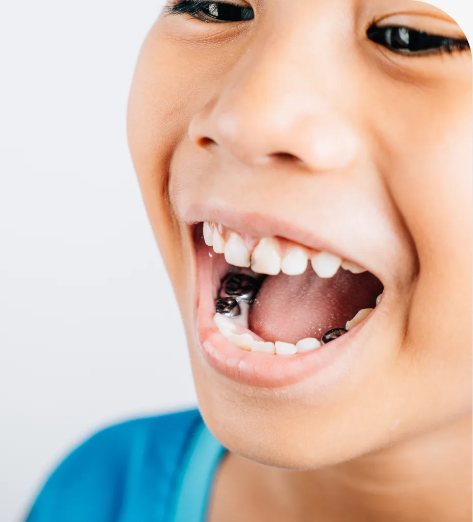 Sea Isle Smiles dental care